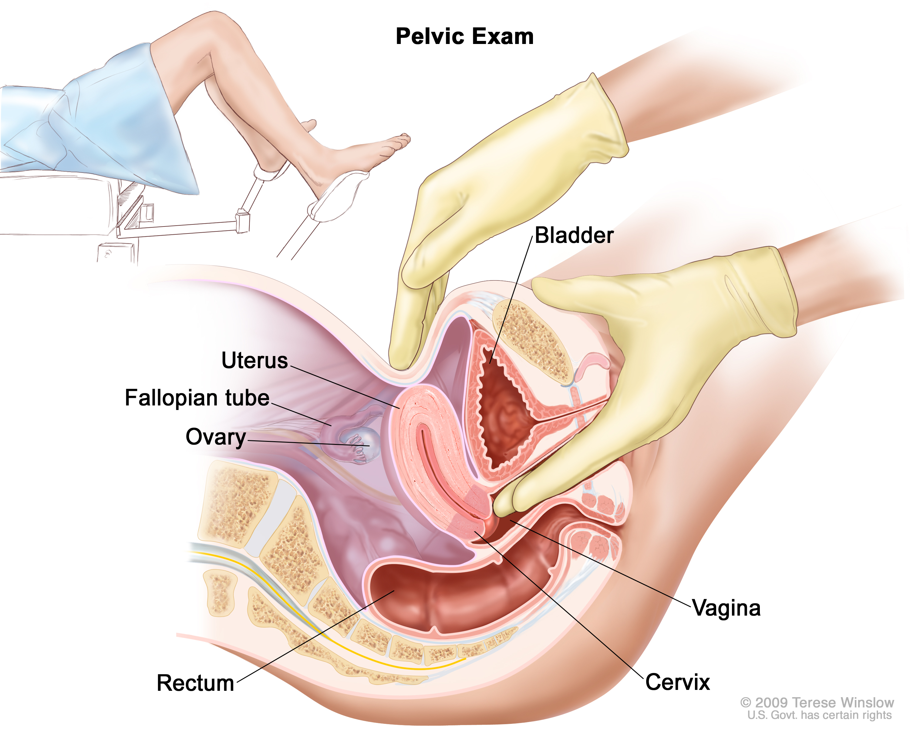 Cervical uterine orgasm