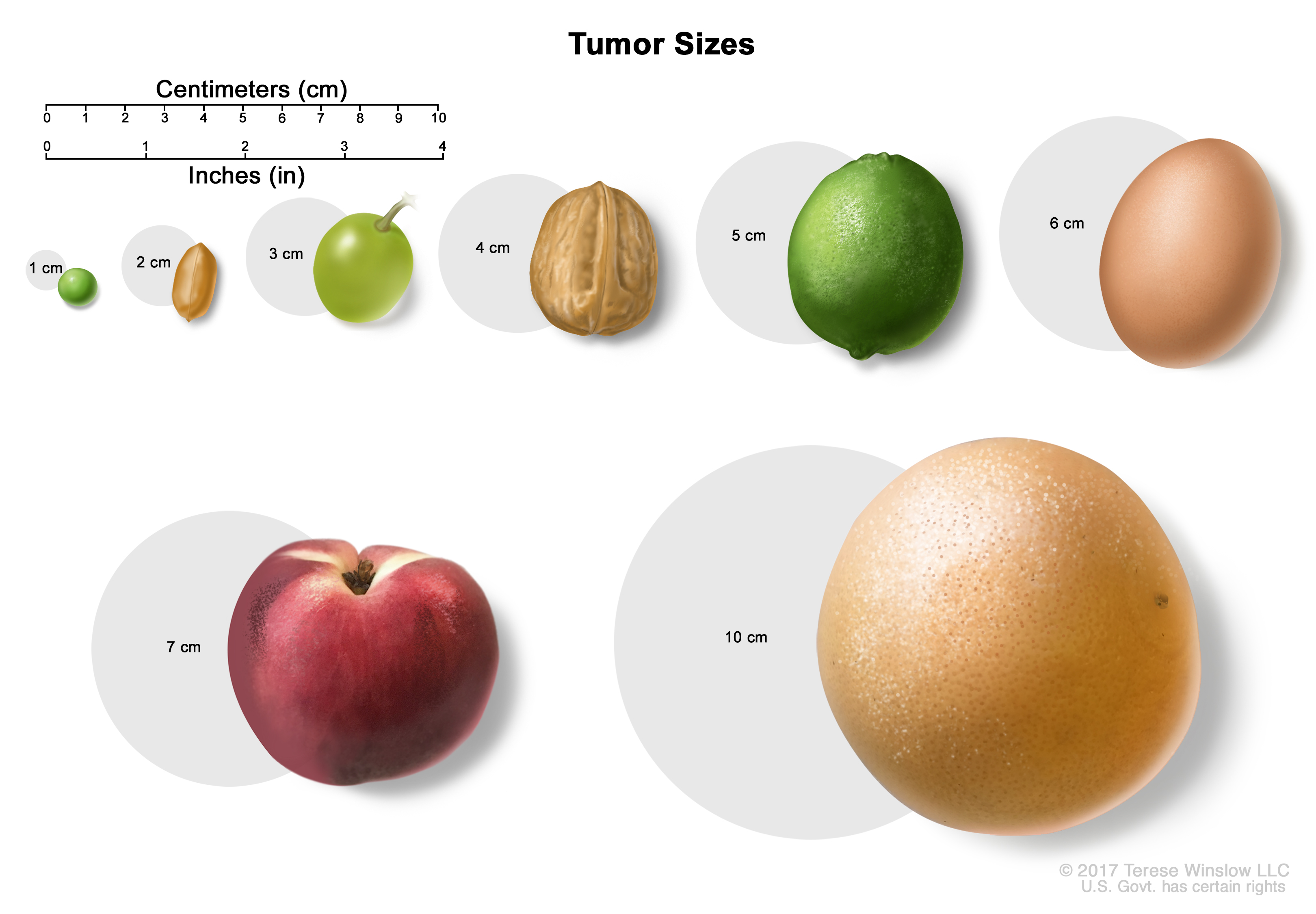 pituitary-tumors-treatment-pdq