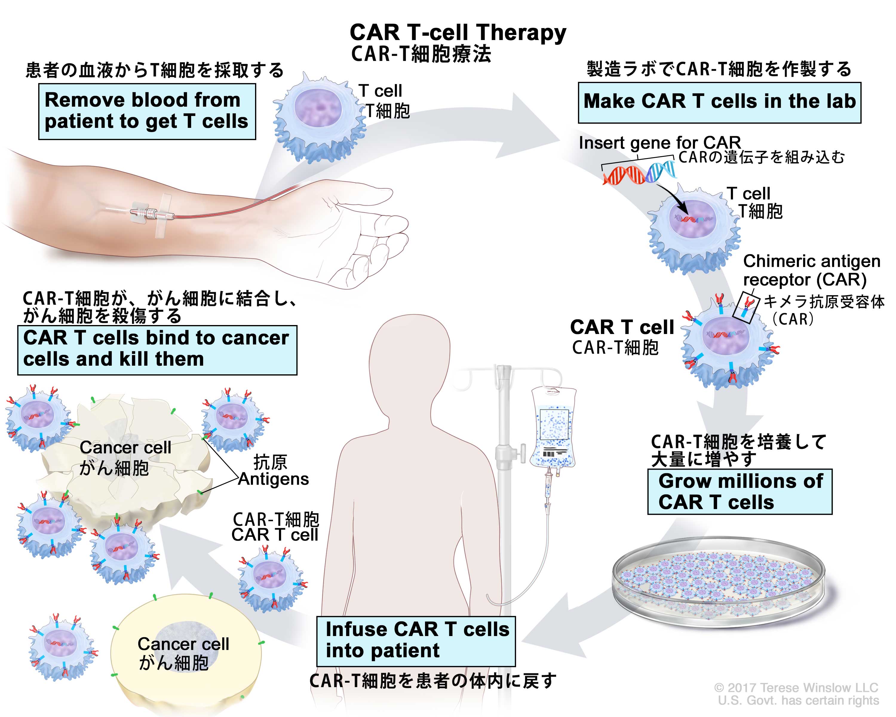 ユーイング肉腫の他の兆候や症状は何ですか?