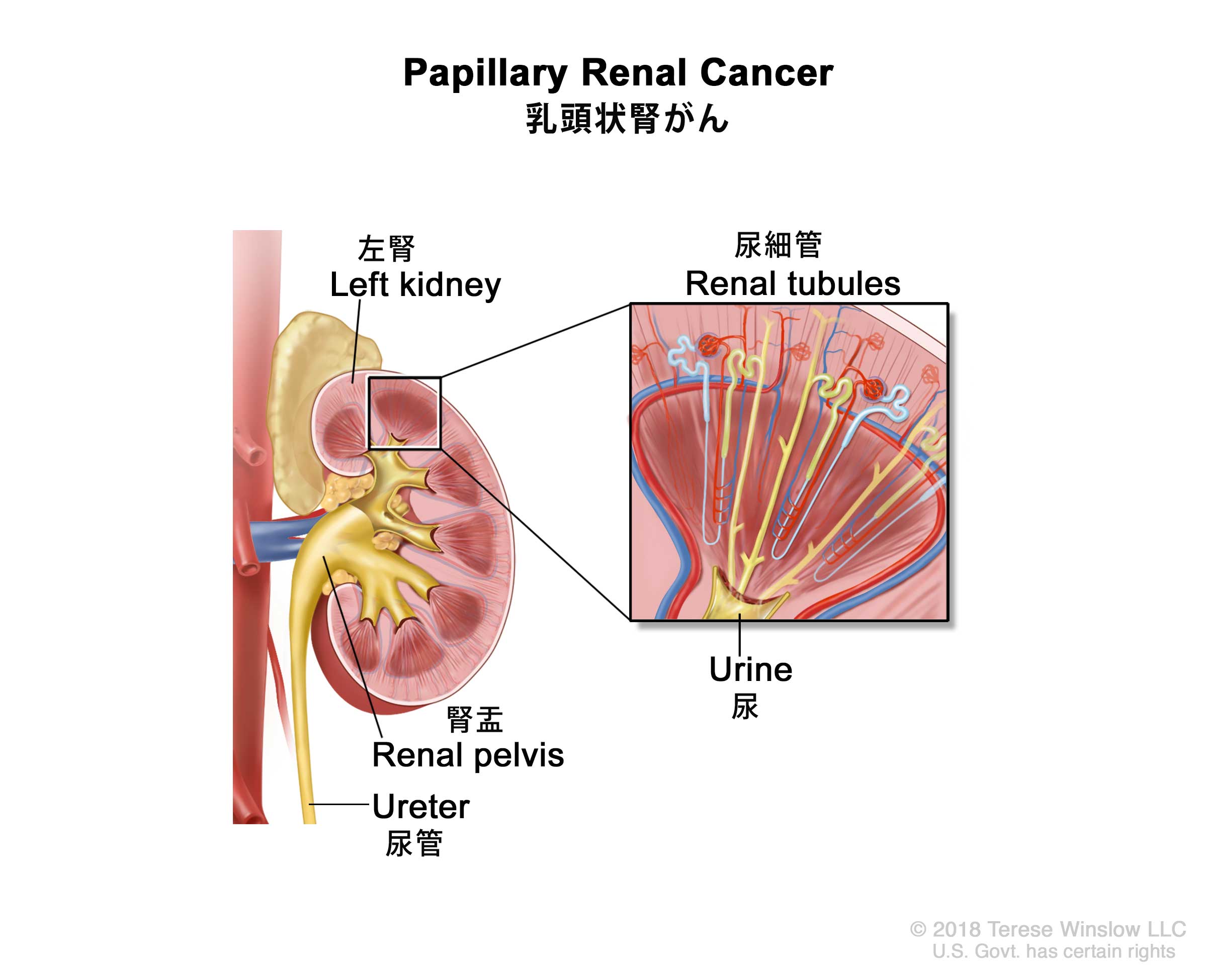  HLRCCの平均余命